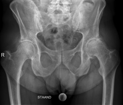 bekken Dokter Dujardin Jan orthopedie heup en knie specialist traumatologie operatie nieuwe knie heup prothese meniscus kruisband sportgeneeskunde izegem hechting kraakbeen operatie chirurg heelkunde arthrose arthritis pijn petré defoort vandendriessche knieprothese heupprothese topdokter arts kunstknie topdokters beste kunstheup topchirurg